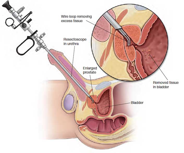 150554954660DrKetanDesai-Prostate-treatments3001 (1)