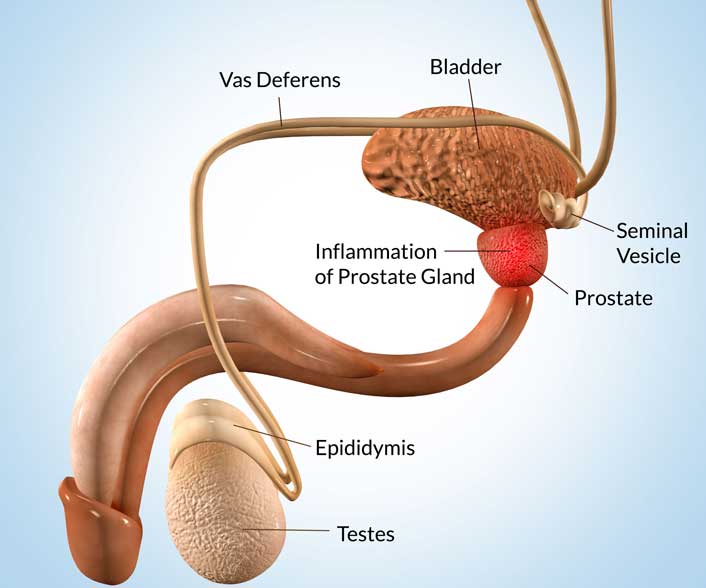 150554994080DrKetanDesai-Prostate-treatments3001
